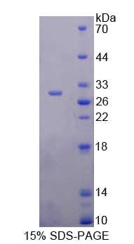 Recombinant Angiopoietin Like Protein 6 (ANGPTL6)