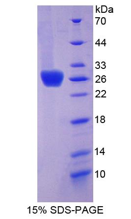 Recombinant Thrombospondin Type I Domain Containing Protein 7A (THSD7A)