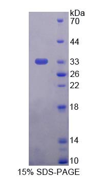 Recombinant Autophagy Related Protein 16 Like Protein 1 (ATG16L1)