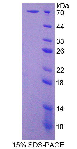 Recombinant Wingless Type MMTV Integration Site Family, Member 16 (WNT16)