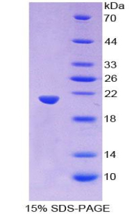 Recombinant Wingless Type MMTV Integration Site Family, Member 11 (WNT11)