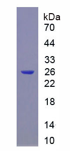 Recombinant Cell Division Cycle Protein 25B (CDC25B)