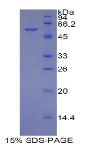 Recombinant CUB And Zona Pellucida Like Domains Protein 1 (CUZD1)
