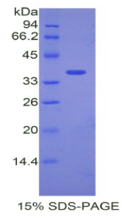 Recombinant Angiopoietin Like Protein 7 (ANGPTL7)