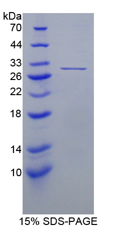 Recombinant Ubiquitin Carboxyl Terminal Hydrolase L4 (UCHL4)