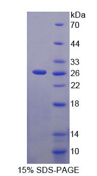 Recombinant Mab21 Domain Containing Protein 1 (MB21D1)