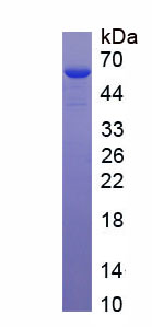 Recombinant Zinc Finger Protein 518B (ZN<b>F518</b>B)