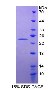 Recombinant Angiopoietin Like Protein 8 (ANGPTL8)