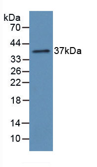 Active Chemokine C-X3-C-Motif Ligand 1 (CX3CL1)