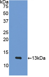 Active Platelet Factor 4 (PF4)