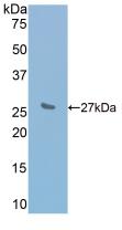 Active Interleukin 2 Receptor Beta (IL2Rb)