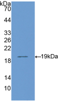 Active Cluster Of Differentiation 14 (CD14)
