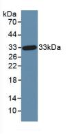 Active Dickkopf Related Protein 1 (DKK1)