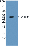 Active Cluster Of Differentiation 26 (CD26)