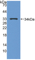 Active Tumor Protein p53 (P53)