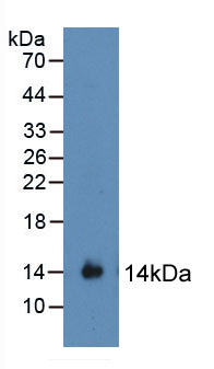 Active Signal Transducer And Activator Of Transcription 3 (STAT3)