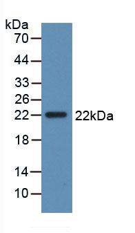 Active Interleukin 28B (IL28B)