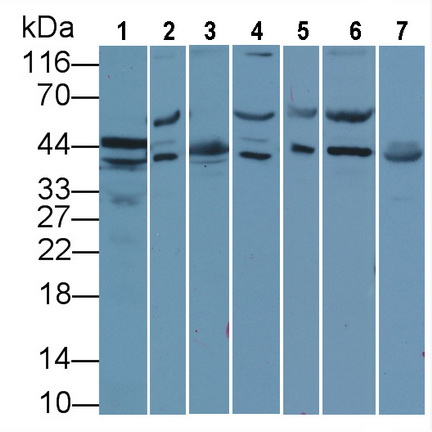 Anti-Extracellular Signal Regulated Kinase 1 (ERK1) Polyclonal Antibody
