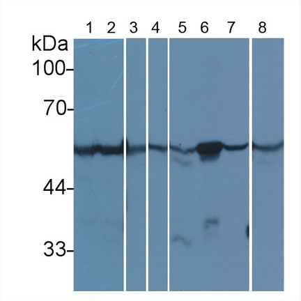 Anti-Tubulin Beta (TUBb) Monoclonal Antibody