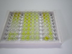 ELISA Kit for Fibrinopeptide B (FPB)