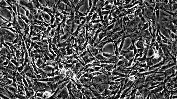 Primary Mouse Aortic Endothelial Cells (AEC)