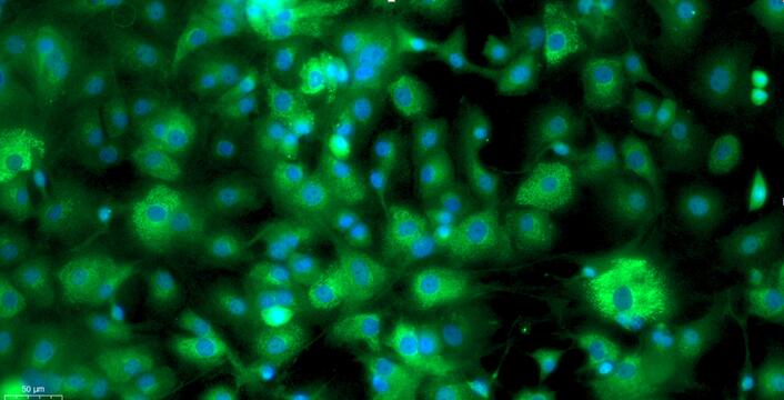 Primary Mouse Annulus Fibrosus Cells (AFC)