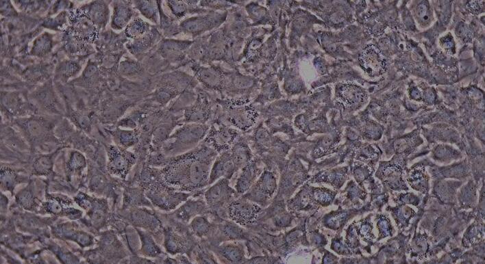 Primary Rat Annulus Fibrosus Cells (AFC)