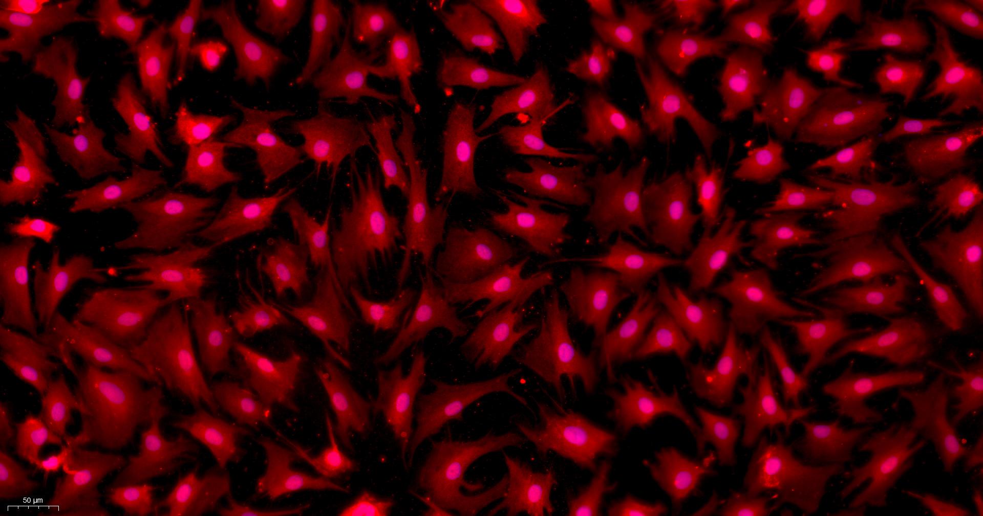 Primary Mouse Umbilical Vein Endothelial Cells (UVEC)