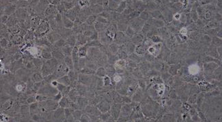 Primary Rat Bronchial Epithelial Cells (BEpiC)