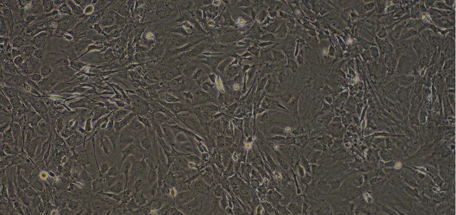 Primary Mouse Skeletal Muscle Cells (SkMC)