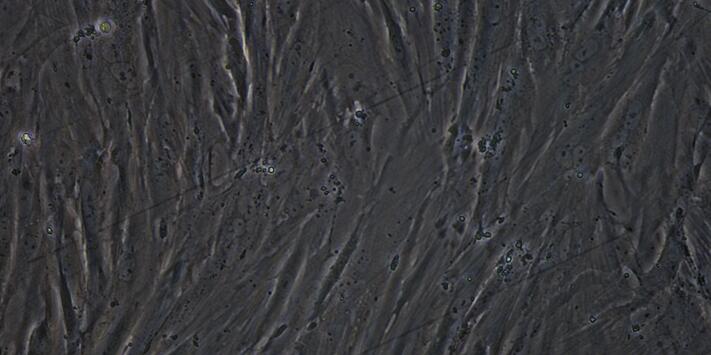 Primary Rabbit Bladder Smooth Muscle Cells (BSMC)