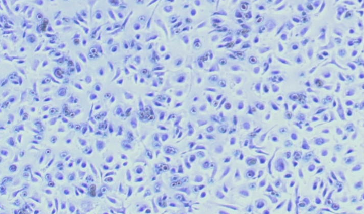 Primary Mouse Bone Marrow-derived Mesenchymal Stem Cells (BMMSCs)