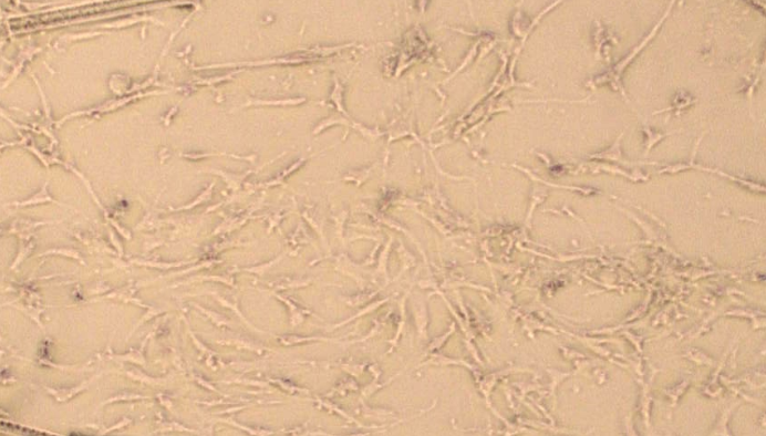 Primary Mouse Adult Dermal Fibroblasts (ADF)