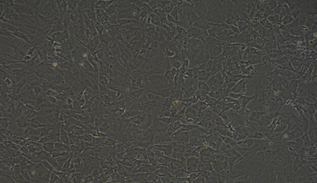 Primary Mouse Osteoblasts (OB)