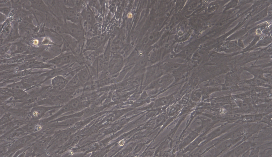 Primary Mouse Ovarian Fibroblasts (OF)