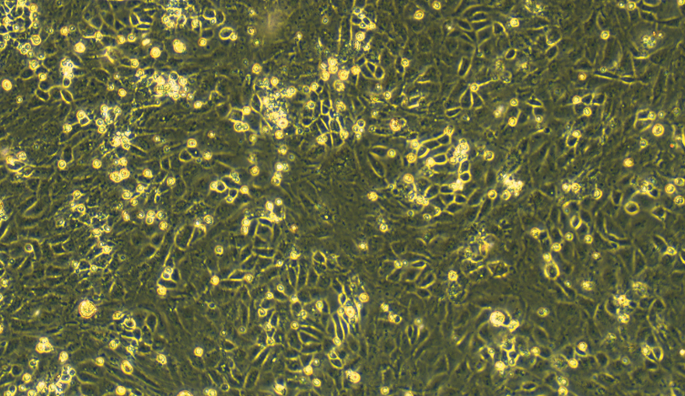 Primary Rat Ovarian Surface Epithelial Cells (OSEC)