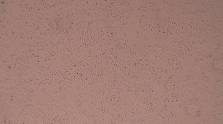 Primary Mouse Aortic Smooth Muscle Cells (ASMC)