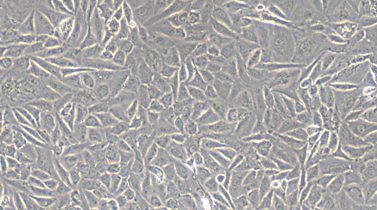 Primary Mouse Ovarian Granulosa Cells (OGC)