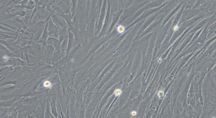Primary Rabbit Small Airway Smooth Muscle Cells (SASMC)