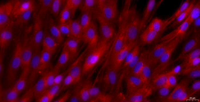 Primary Rat Corpus Cavernosum Smooth Muscle Cells (CCSM)