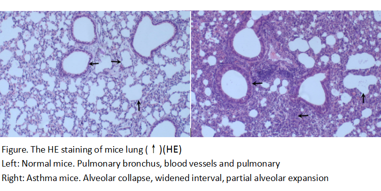 Mouse Model for Asthma