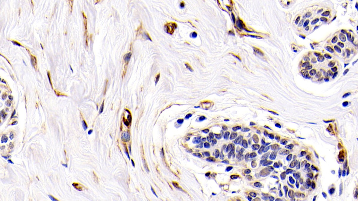 Biotin-Linked Monoclonal Antibody to Platelet Derived Growth Factor AA (PDGFAA)
