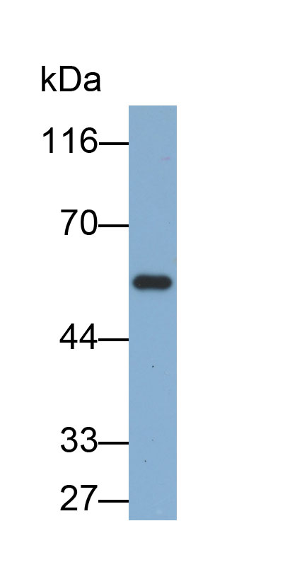 Biotin-Linked Polyclonal Antibody to Fc Fragment Of IgG Low Affinity IIIa Receptor (FcgR3A)