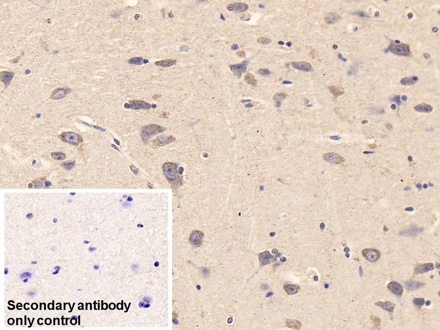 Monoclonal Antibody to Brain Derived Neurotrophic Factor (BDNF)