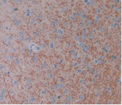 Monoclonal Antibody to Fibroblast Growth Factor 1, Acidic (FGF1)