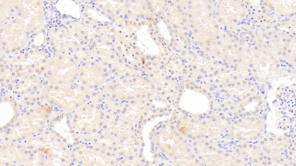 Monoclonal Antibody to Interleukin 12B (IL12B)