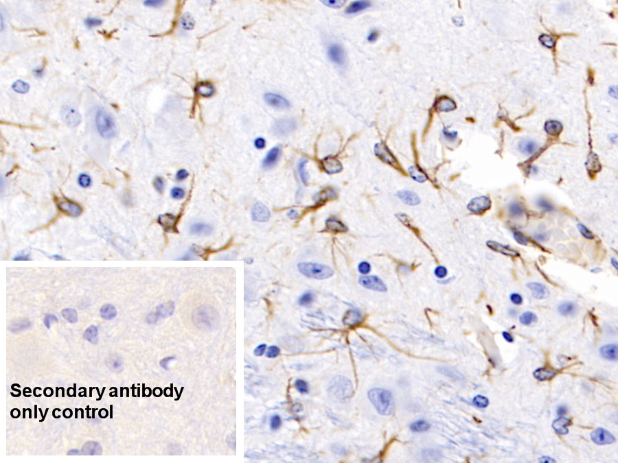 Monoclonal Antibody to Glial Fibrillary Acidic Protein (GFAP)