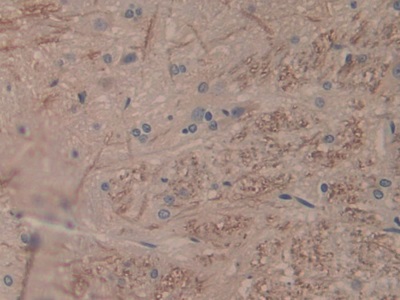 Monoclonal Antibody to Interleukin 1 Alpha (IL1a)
