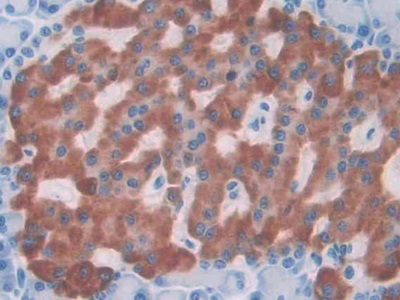 Monoclonal Antibody to Interleukin 1 Alpha (IL1a)