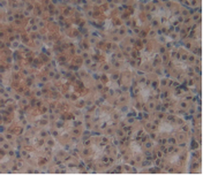 Monoclonal Antibody to Stem Cell Factor Receptor (SCFR)